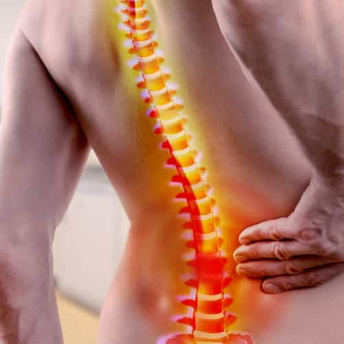 Spine Surgery in Turkey for UK Patients – End Chronic Back Pain for Good